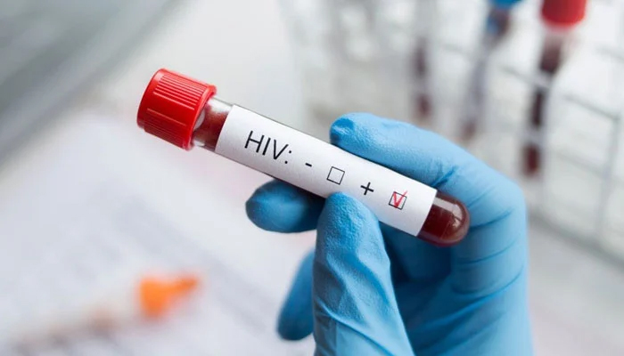 پاکستان میں 15 ماہ کے دوران 2 ہزار سے زائد بچوں میں ایچ آئی وی کی تشخیص، سندھ سب سے زیادہ متاثر